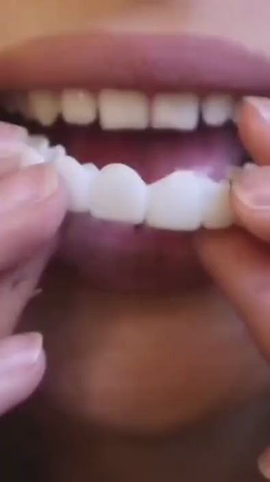 Instant and Confident on Smile Fit Flex Cosmetic Teeth Denture Teeth